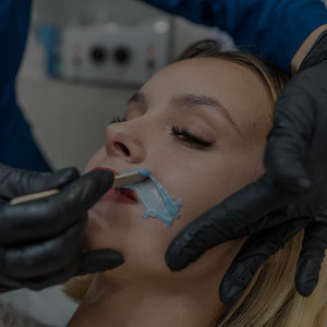 CERETTA SOPRALABIALE O ZONE VISO (MENTO/COLLO)